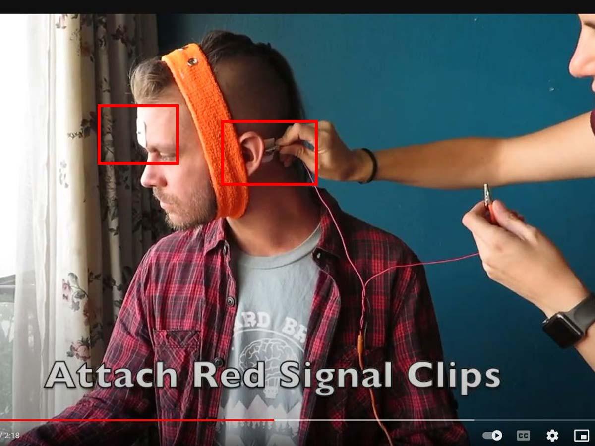 Audiologist attaching electrodes. (From: YouTube/Backyard Brains)