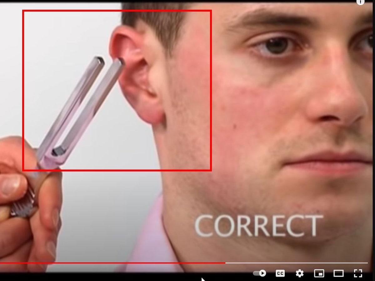 Hold the tuning fork perpendicular to the ear canal. (From: Youtube/Oxford Medical Education)