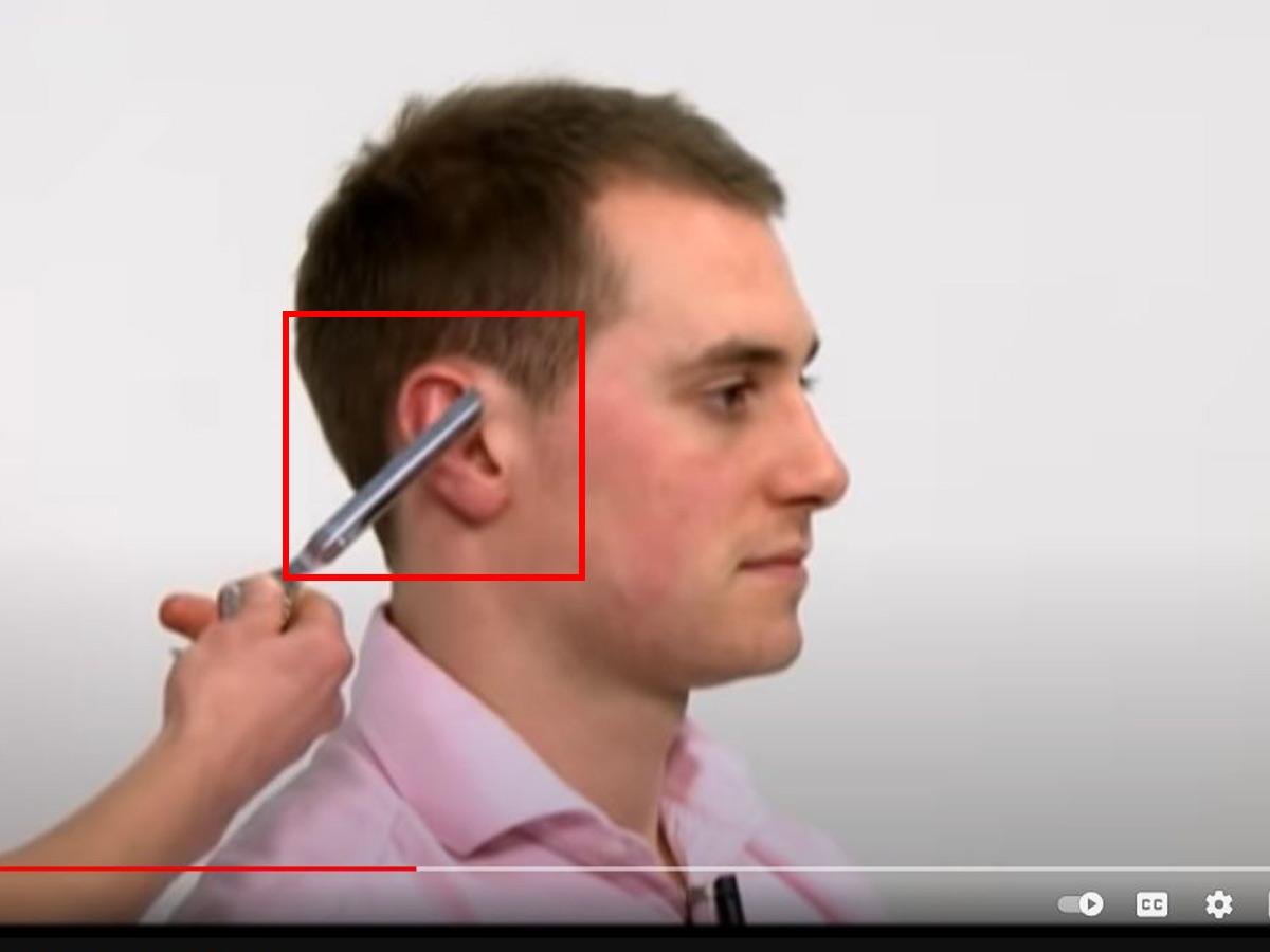 Keep holding for 2-3 seconds.(From: Youtube/Oxford Medical Education)