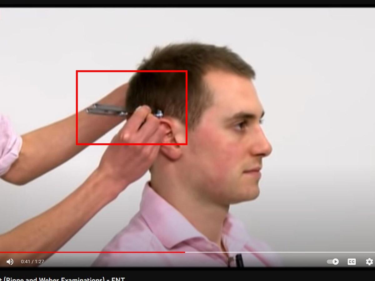 Press the base of the tuning fork against a bony structure near the ear. (From: Youtube/Oxford Medical Education)
