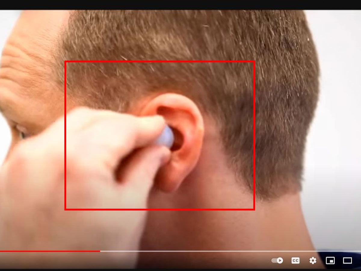 Positioning the putty (From: Youtube/Mack's Earplugs)